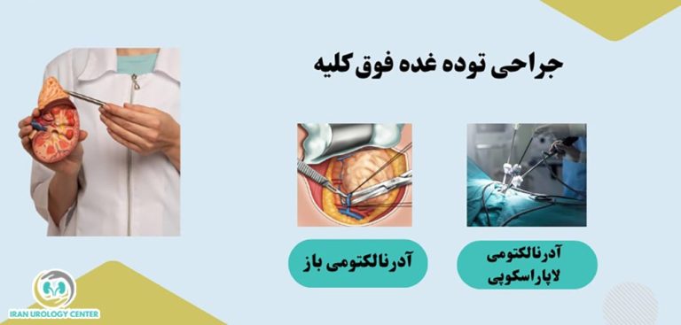 غده فوق کلیه