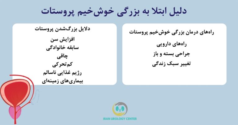 مبتلا شدن به پروستات