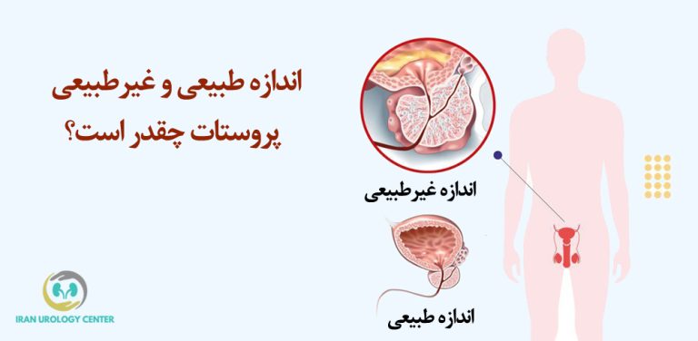 اندازه پروستات