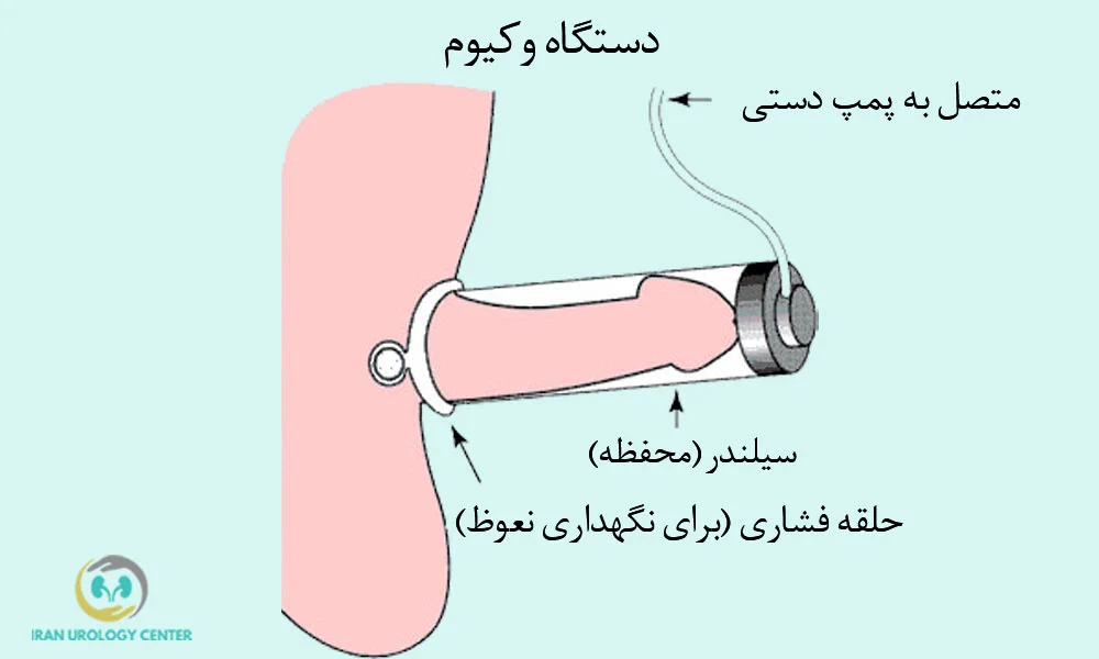دستگاه وکیوم